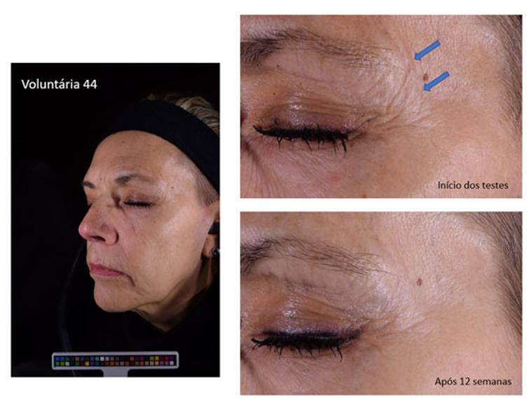 情绪护肤敏感肌,情绪美容芳疗系列化妆品