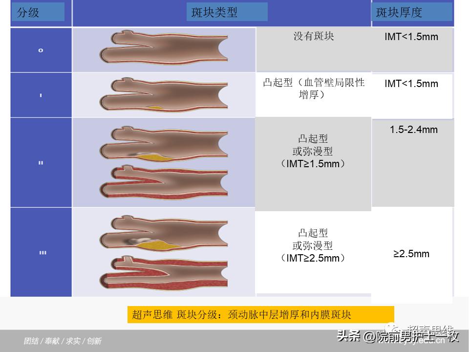 颈动脉斑块的相关知识,颈动脉斑块应该注意哪些事项