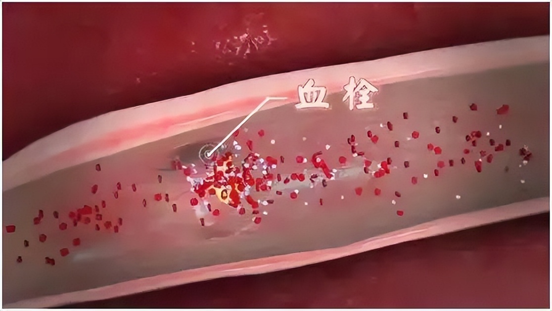 心跳次数在这个范围内的人更长寿,心跳的快慢决定着人的寿命长短