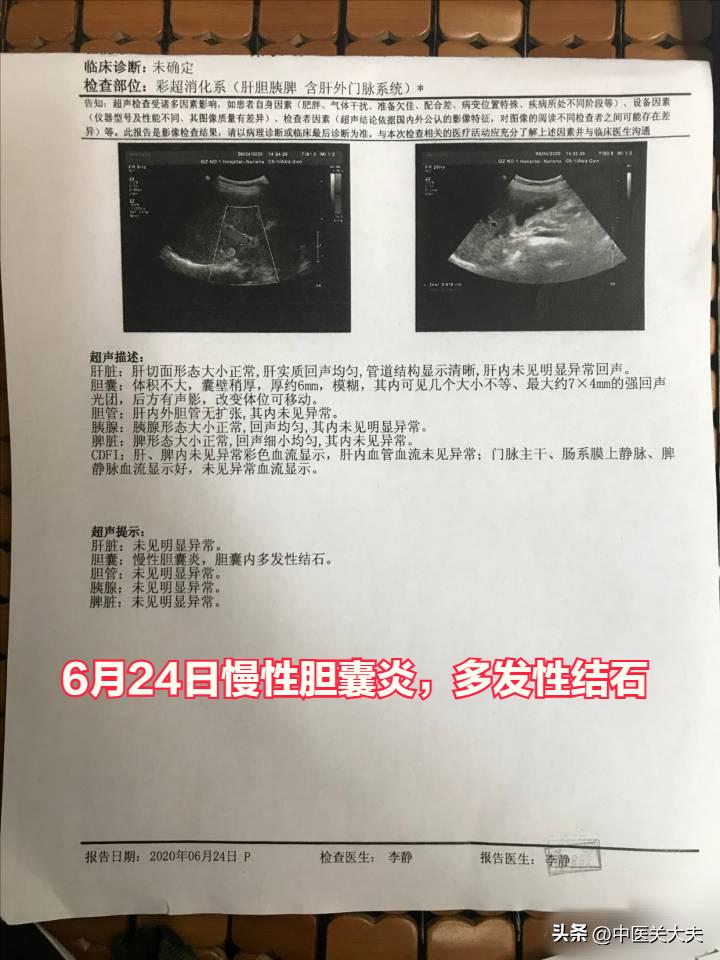 产妇为什么得胆囊炎胆囊结石,孕晚期有胆囊炎胆囊结石怎么办