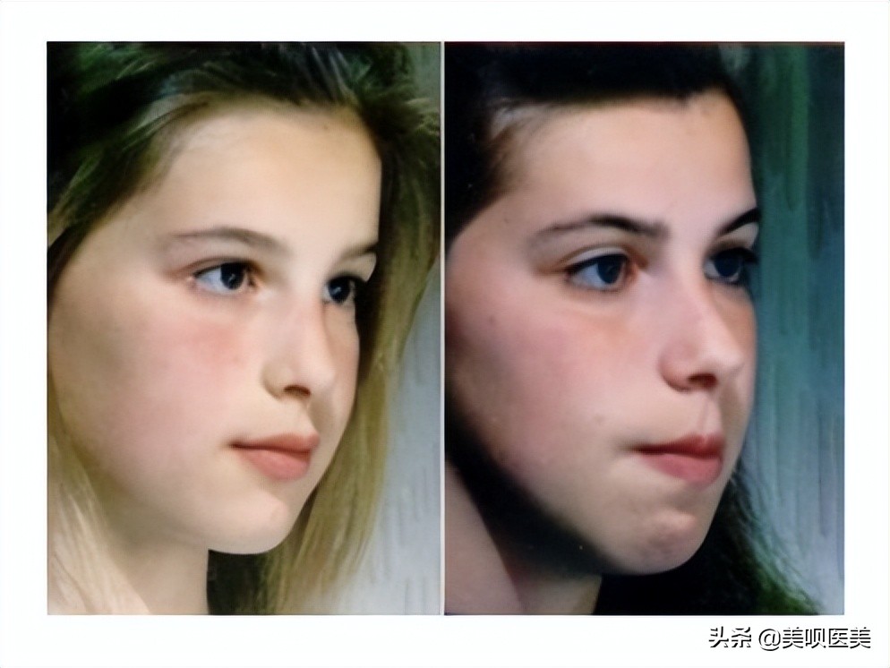 素颜太丑怎么补救,素颜丑怎么改善