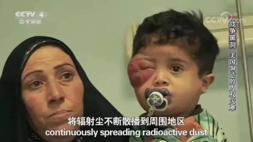 女孩生下来有六个手指和六个脚趾，这一切却是人为导致的...真相没那么简单！