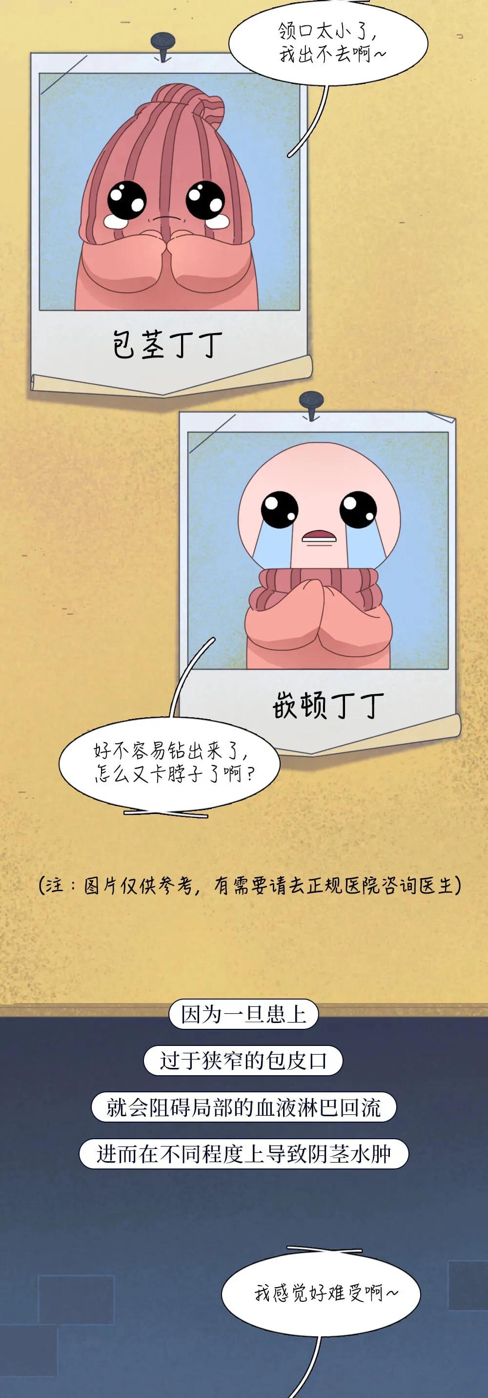 割了包皮以后的男生会变成什么样?