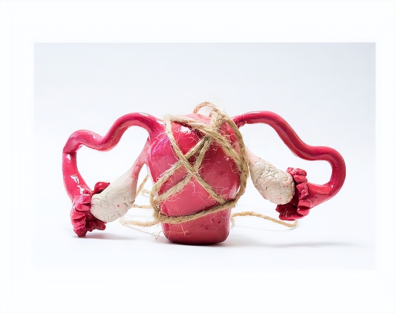 石女有了月经还算石女吗,石女有其他并发症吗