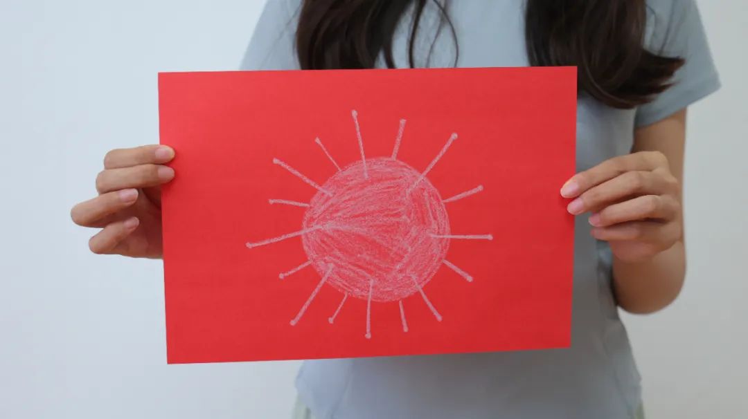 脚后跟开裂起皮什么原因,脚后跟开裂是缺维生素吗