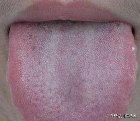 治脾不治肝,养肝疏肝调理脾胃的中成药