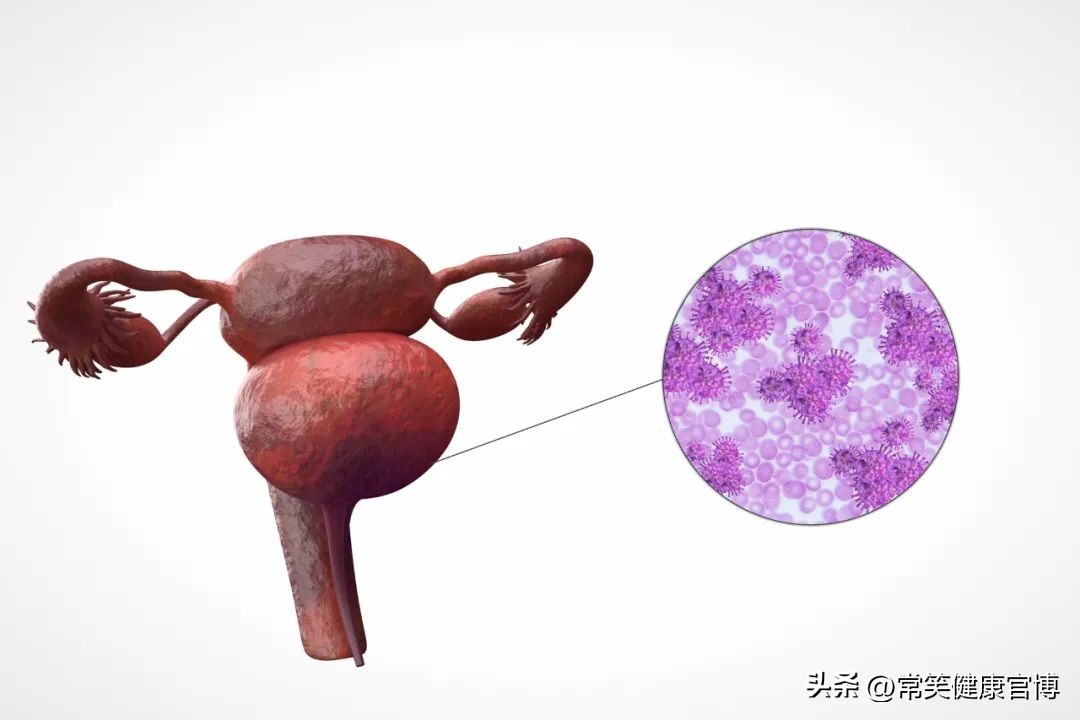 女性的难言之隐有哪些,女性难言之隐的病