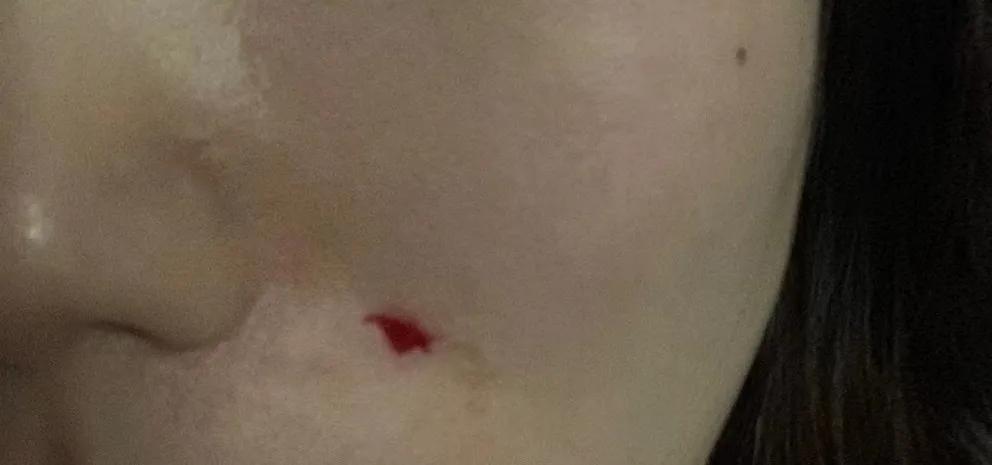 去医院美容科看皮肤靠谱吗,毁容美容