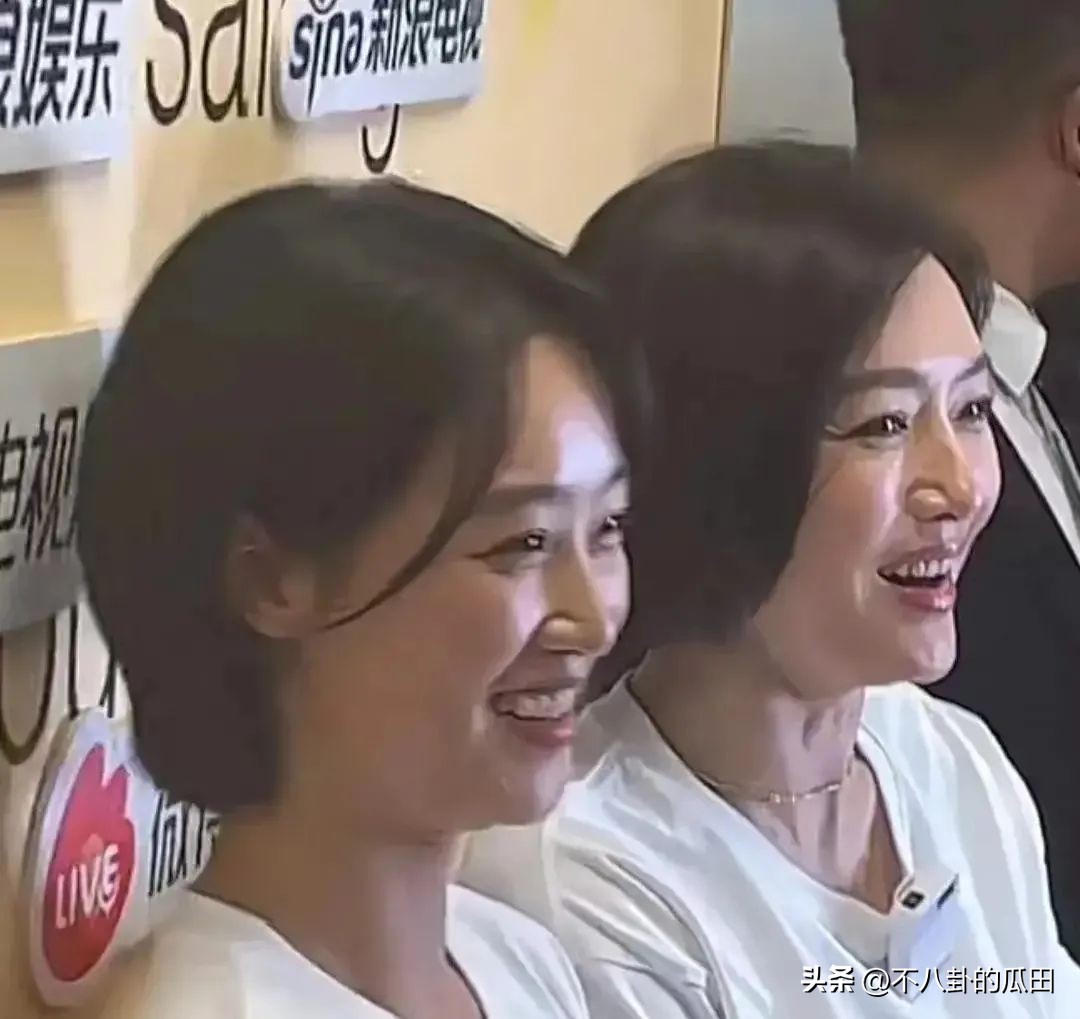 蔡徐坤下巴太尖惹争议图片,蔡徐坤下巴是假体吗