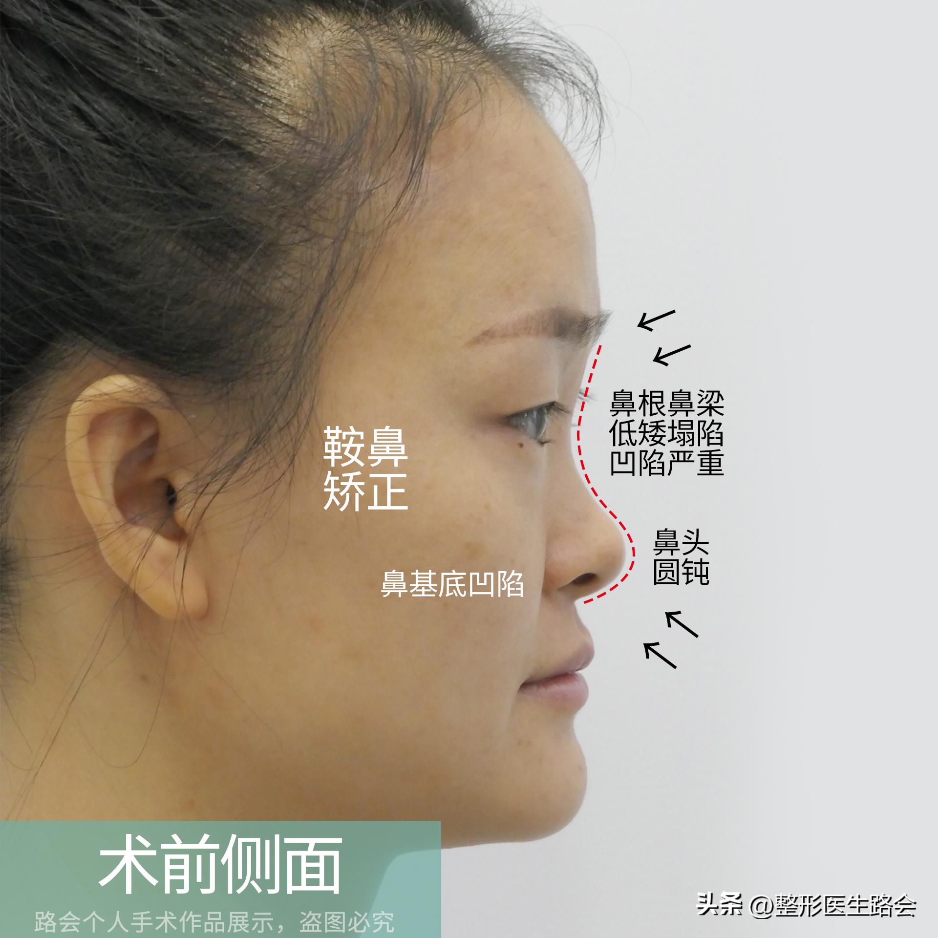 人生第一次动手术的感悟,人生第一次手术的经历