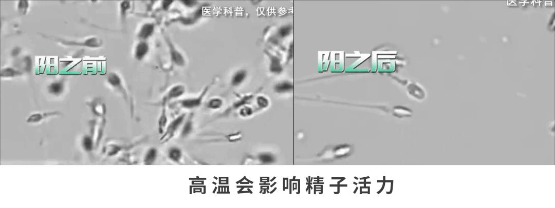 孕早期阳了会导致胎儿畸形吗,孕妇阳了胎儿会畸形吗