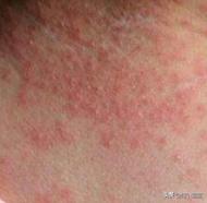 天气再热不能给孩子穿什么,孩子夏天特别热需要擦痱子粉吗