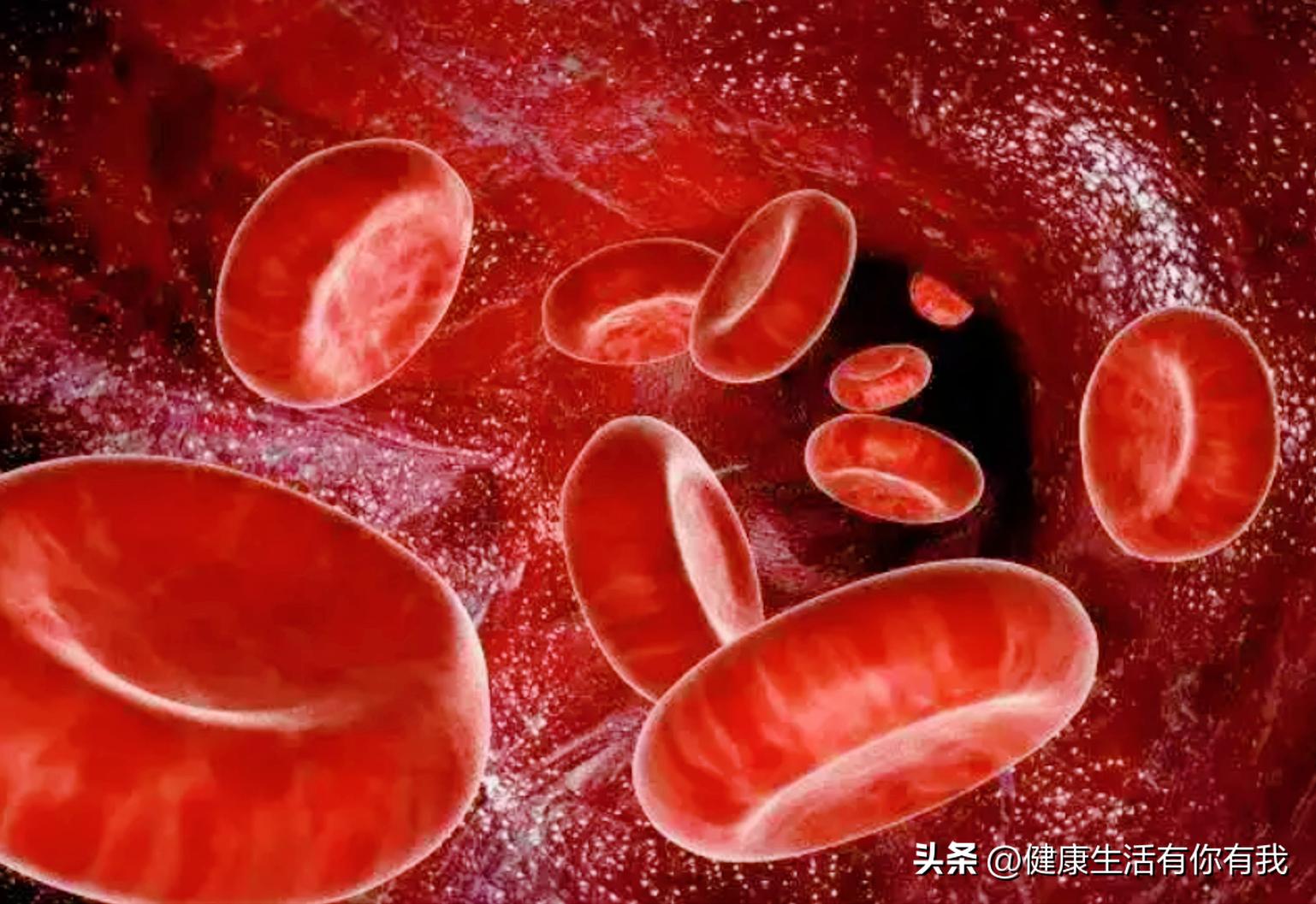 什么是血尿和尿潜血,什么是血尿是怎么回事