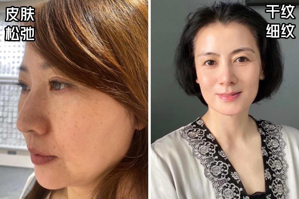 40岁皮肤护理只用精华和面霜,30岁的女性擦什么面霜比较好