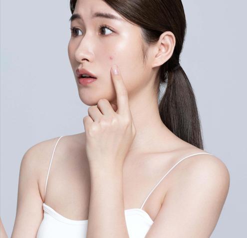 皮肤油腻易出油用什么香皂好,男士夏天皮肤出油