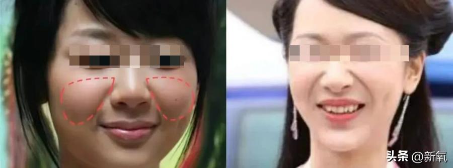 6位一大笑颜值就会崩塌的女明星,看起来笑的很魔性的女明星