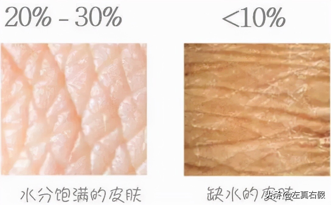 biooil百洛油真假,bio百洛油新包装