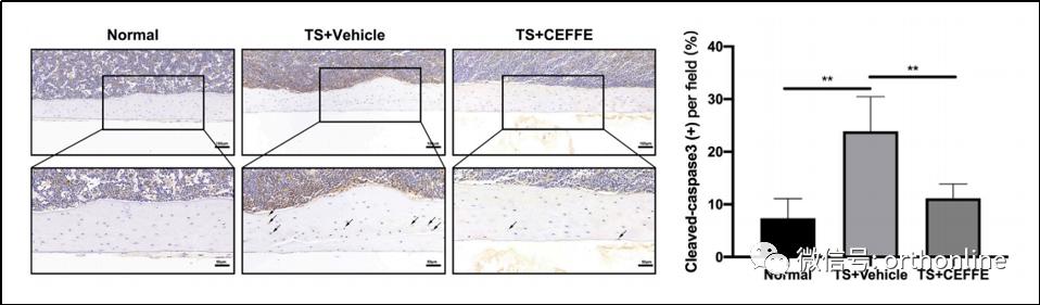 无细胞脂肪活性蛋白预防骨质疏松研究