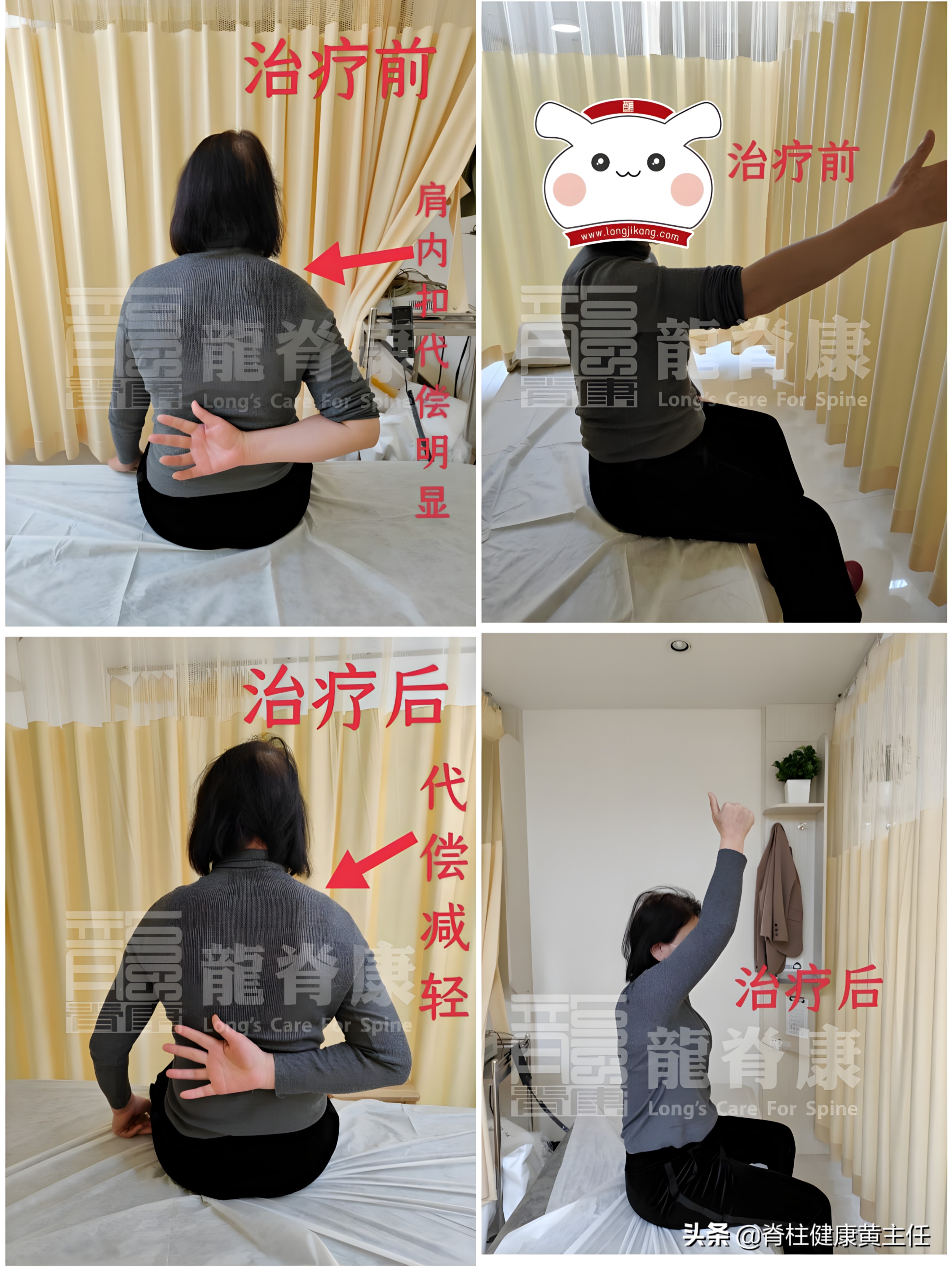 长期肩膀疼痛是什么原因,肩膀疼痛活动受限