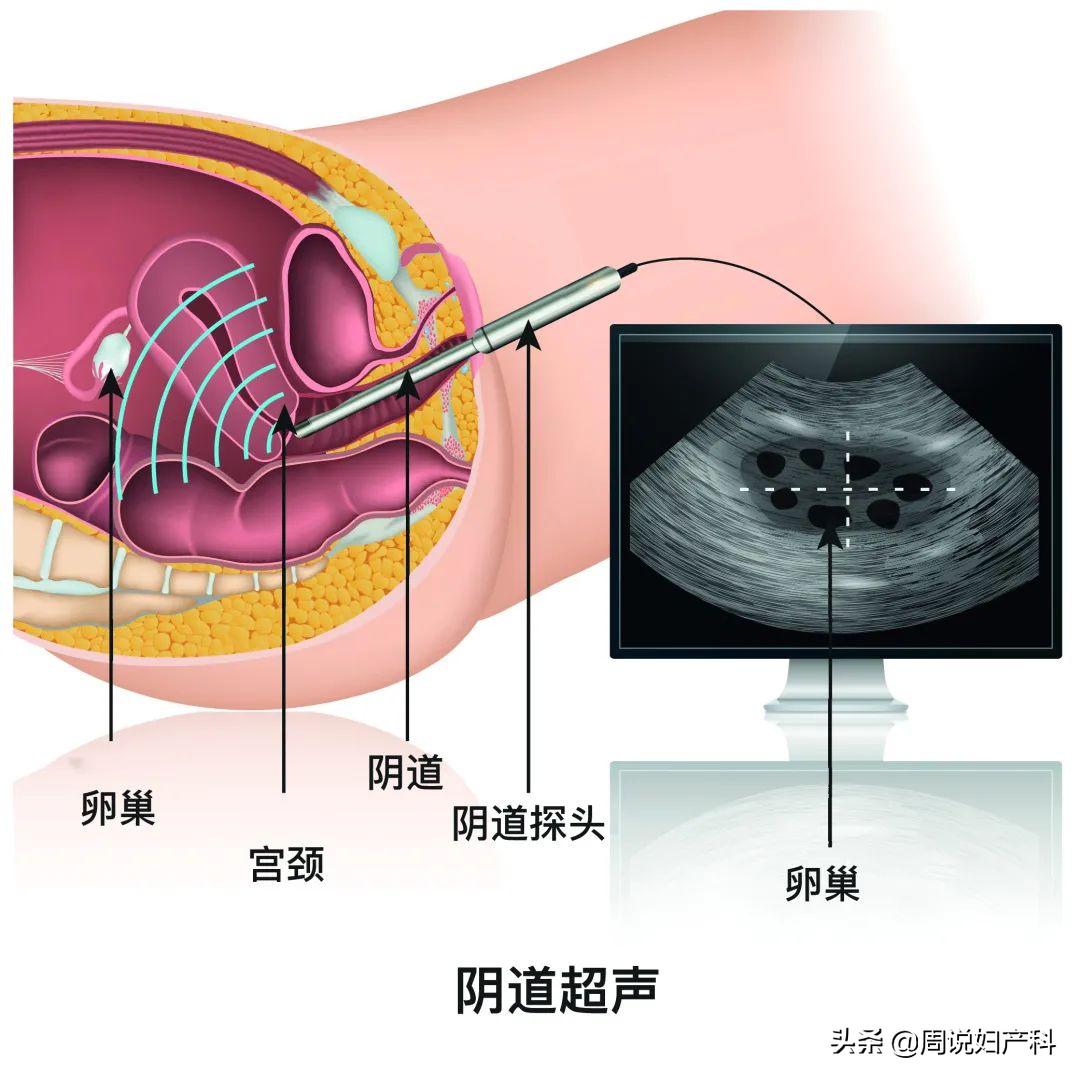 妇科各项检查的最佳时间表,妇科检查内容记录