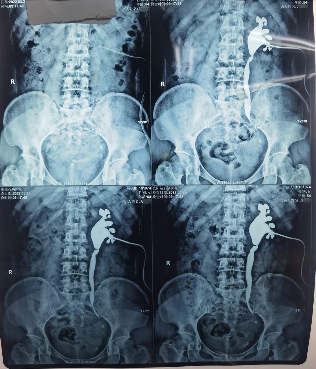 狭路相逢勇者胜应该怎么应对,狭路相逢勇者胜怎么过