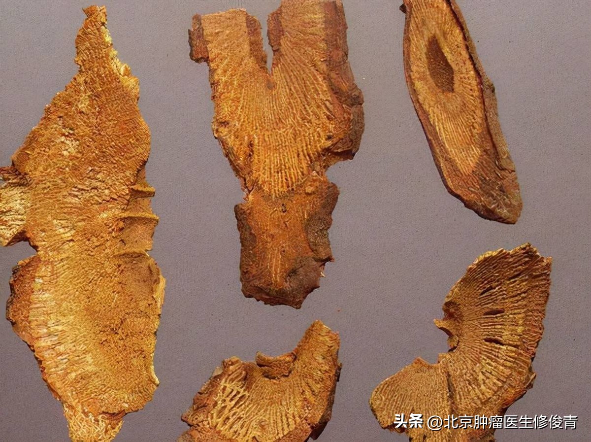 治疗乳腺癌转移的中医药方,消瘤汤中医治疗乳腺癌的经验方