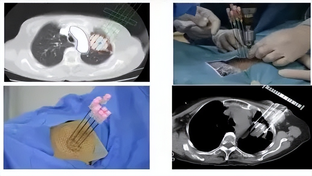 朱康顺医生怎么样,朱康顺怎么样