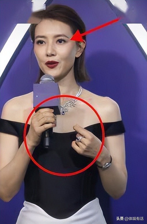 面部衰老皱纹图,面部衰老皱纹解剖图