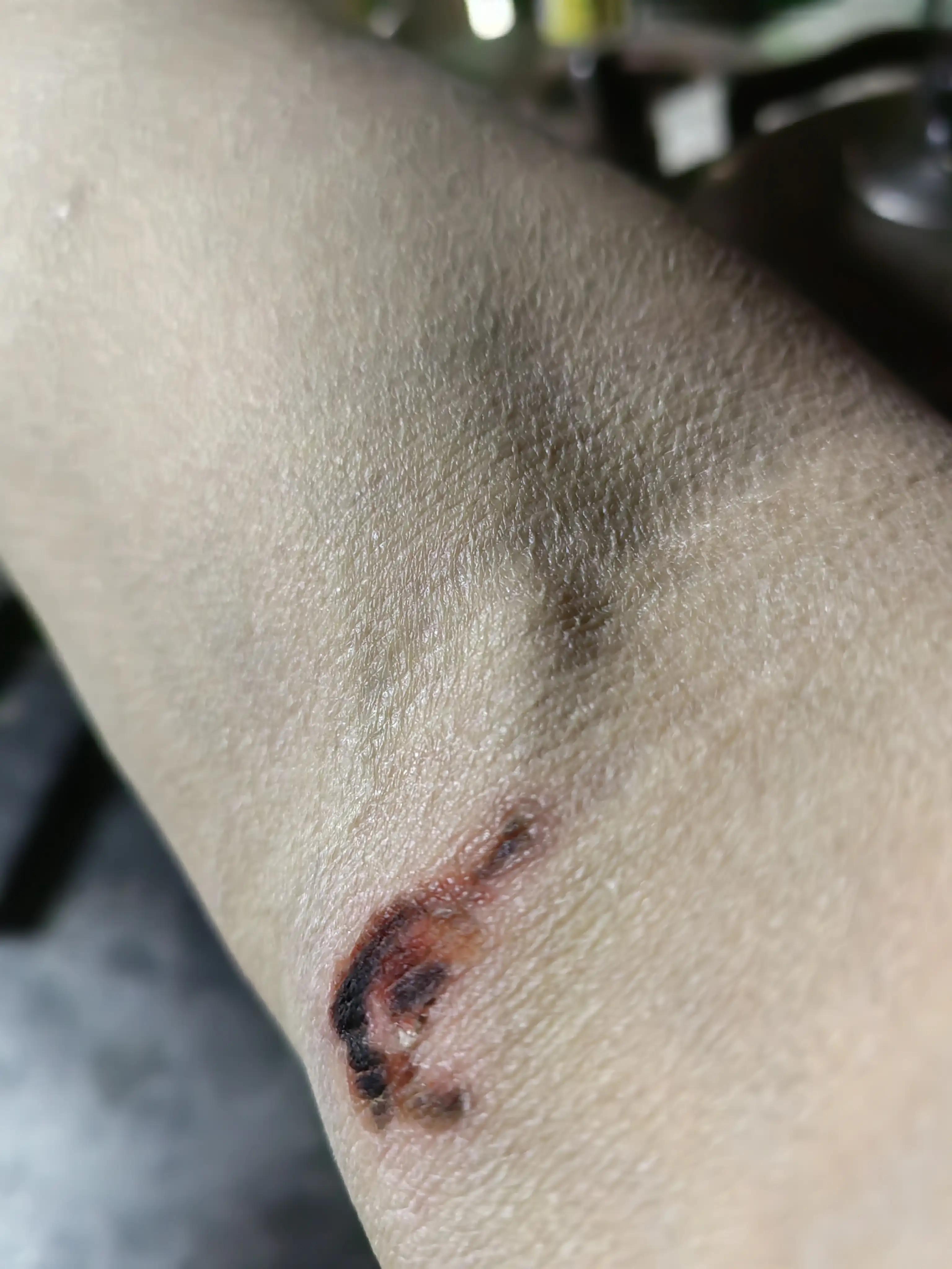 养狗人是怎么处理被狗咬到的,养狗被自家狗咬伤了怎么办