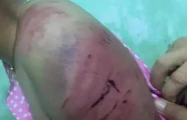 缅甸孟邦一父亲强行强奸亲生女儿，女孩被打遍体鳞伤，天理何在。