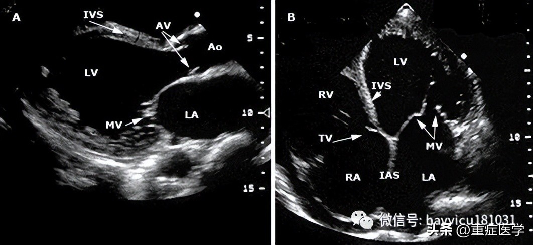 休克评估与处理课件,休克评估最有效指标