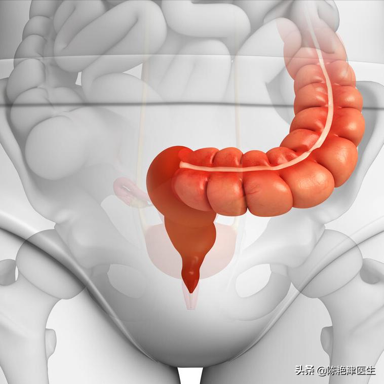肠息肉是肠癌最大的祸根,肠息肉有癌变风险中医怎么预防