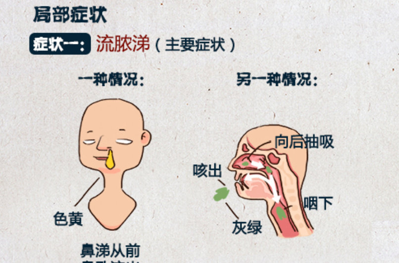 儿童鼻窦炎炎症很高,儿童鼻窦炎百科介绍
