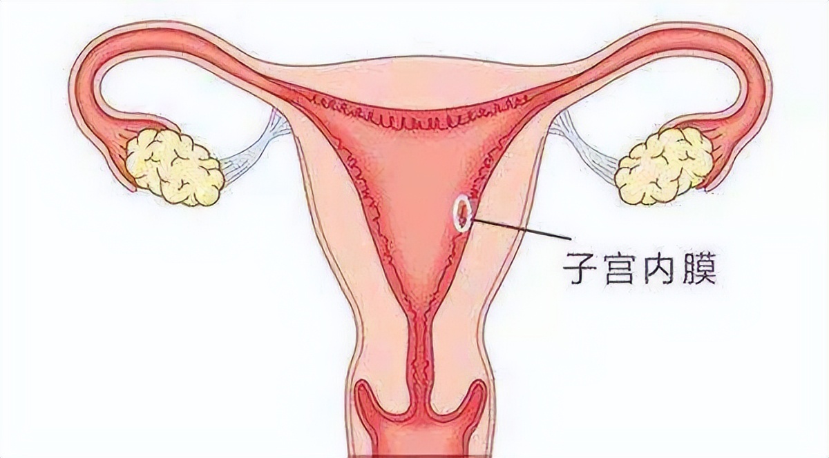 清宫后子宫内膜回声不均匀正常吗,产后子宫内膜回声不均匀什么意思