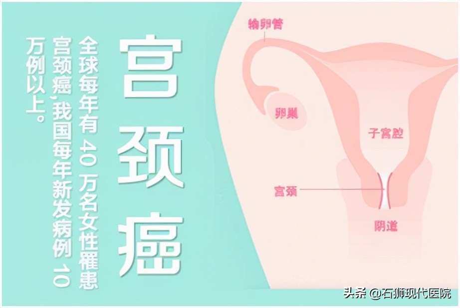 石狮市医院子宫切除,宫颈癌前病变微创手术