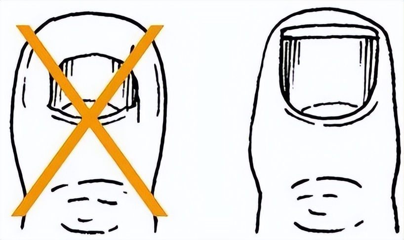 被石头划伤肿了,被石头划伤了肿了怎么办