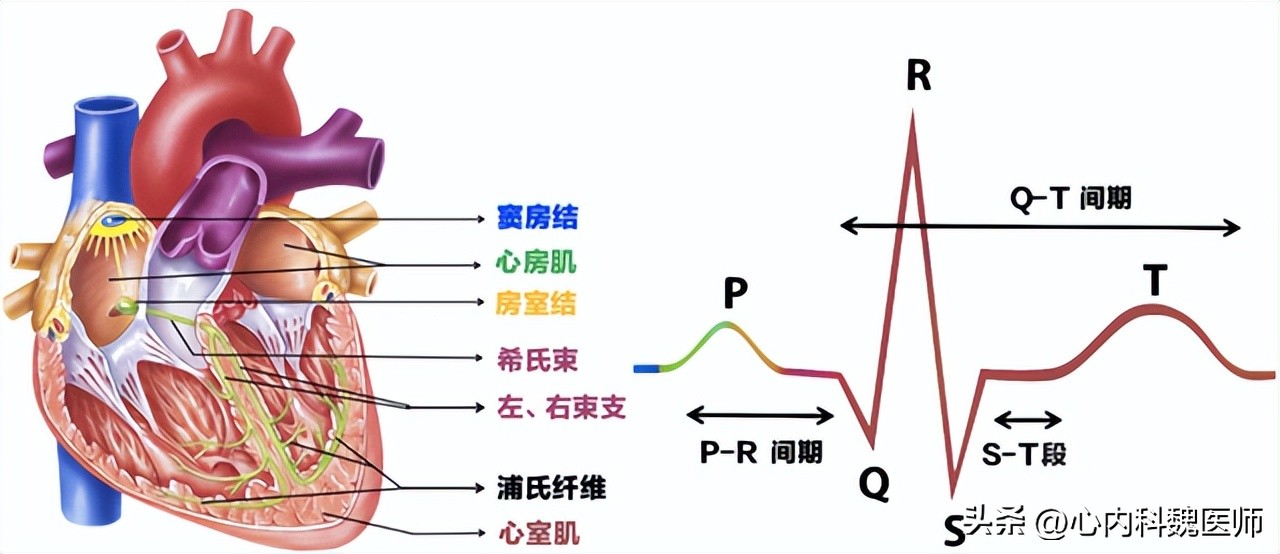 体检窦性心律正常心电图啥意思,体检报告显示窦性心律是什么意思