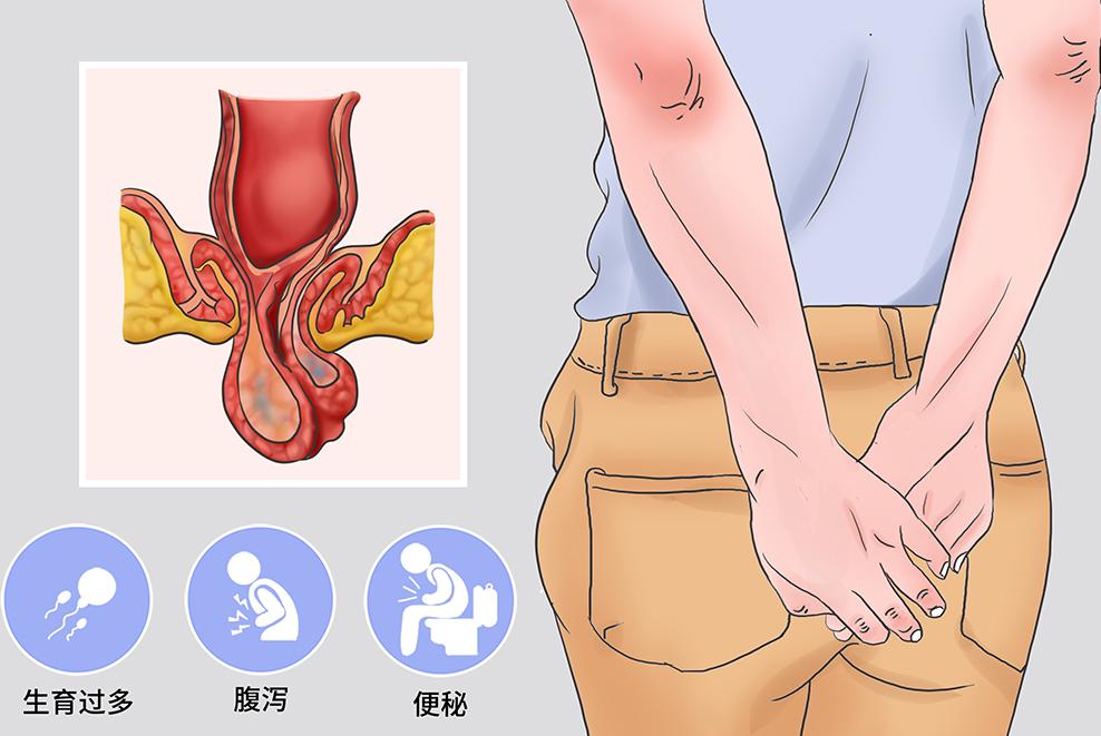 一打喷嚏、咳嗽就漏尿？医生：这是一种病，中老年女性更常见