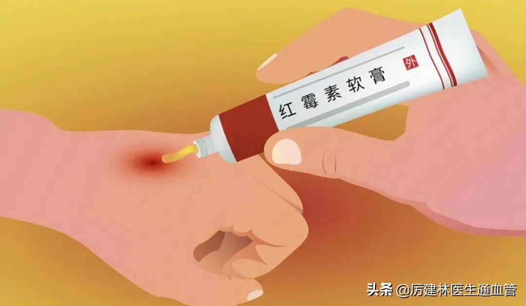 红霉素眼膏和红霉素软膏区别在哪,红霉素软膏和红霉素眼膏有啥区别