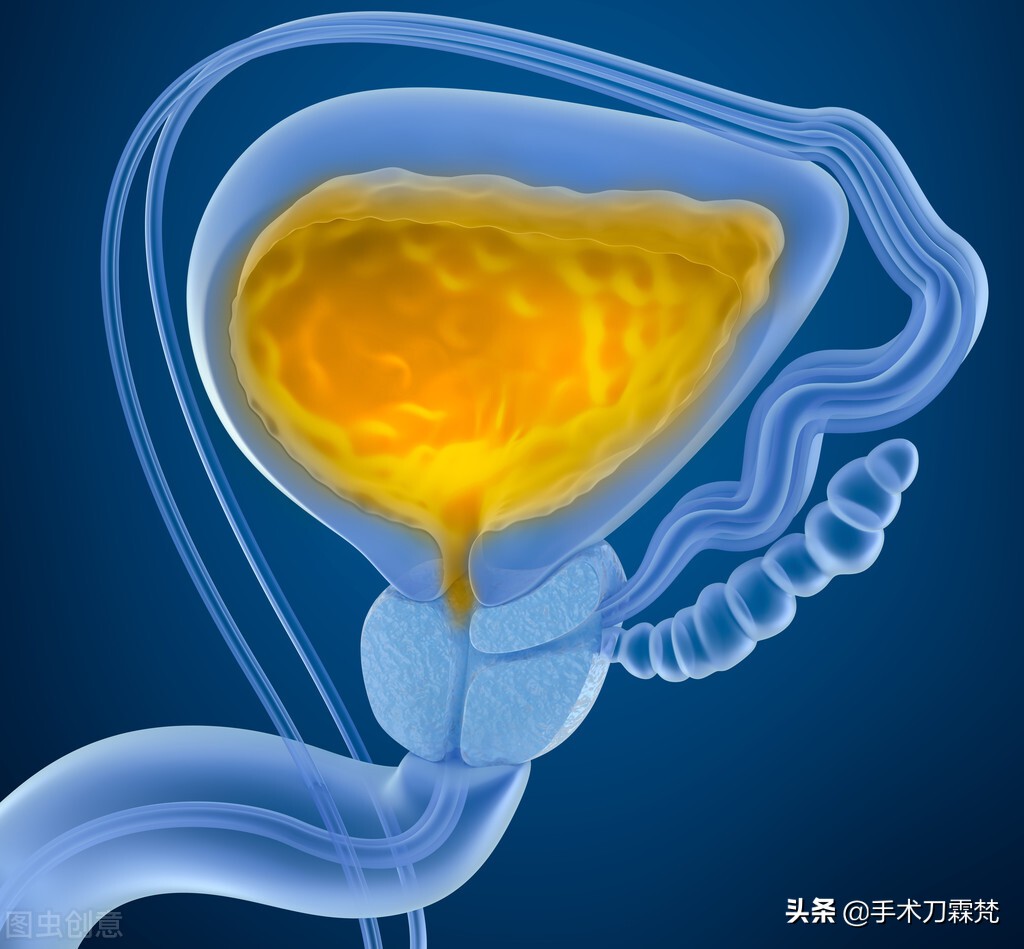 尿突然急憋不住什么原因,尿憋急了腰胀