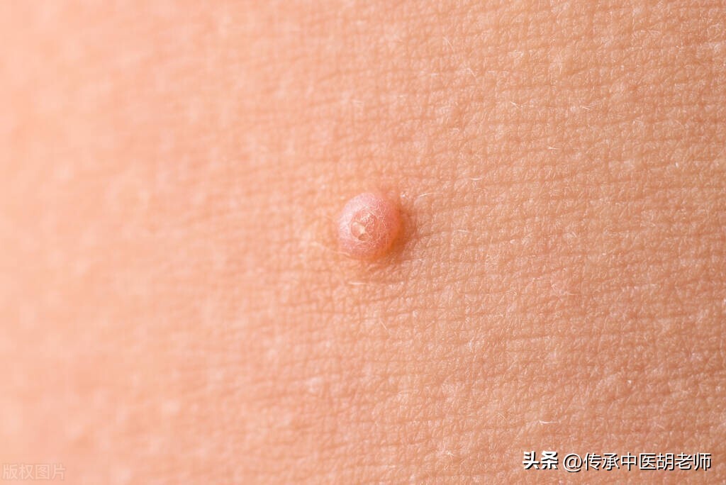 逍遥丸配一物，不仅疏肝解郁，还可治这4种病，建议收藏！