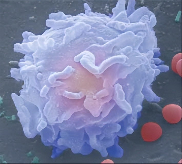 白细胞计数高应该怎么办？