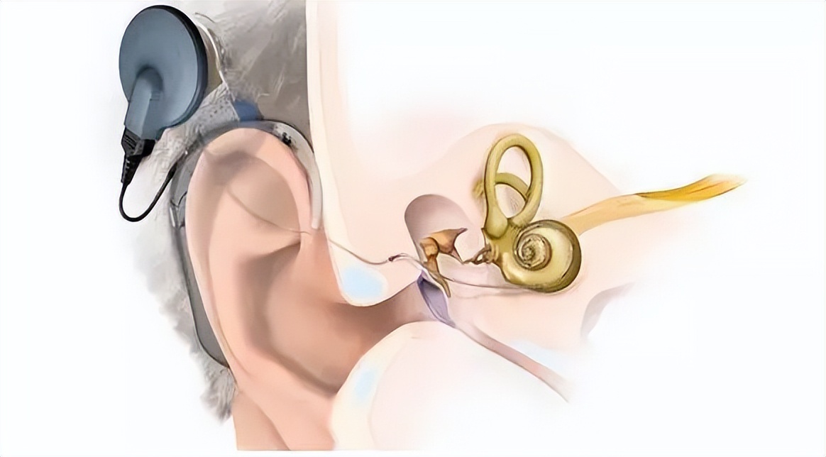 等离子表面处理机能干什么,等离子表面处理的作用