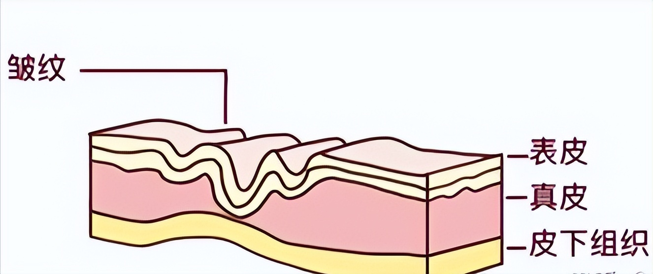抗衰祛皱纹逆龄变美,紧致抗衰淡法令纹的项目