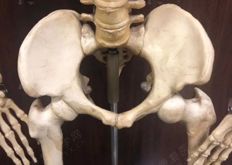 骨盆旋移症就是骨盆不正,怀疑骨盆不正查什么科