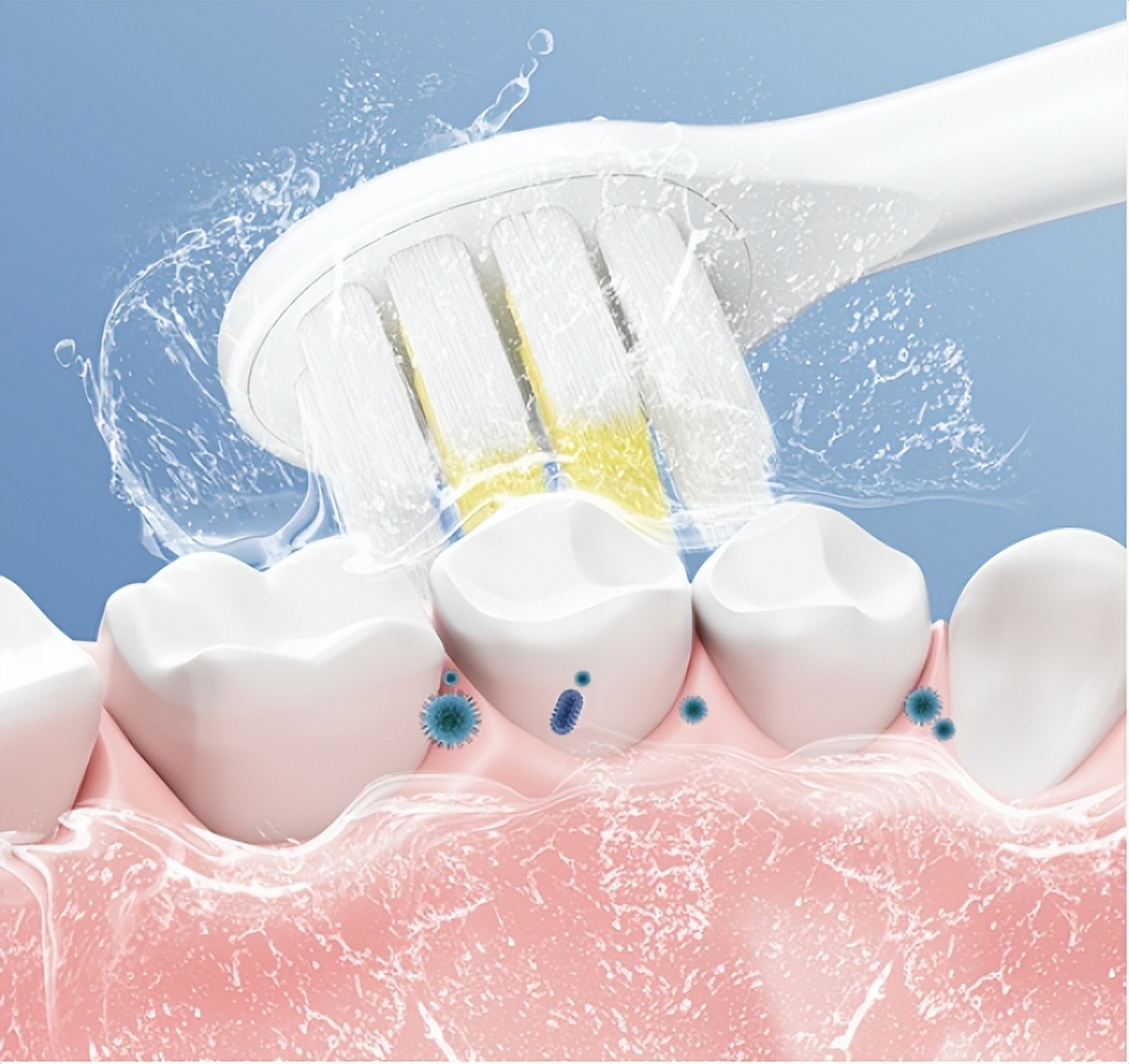 儿童用电动牙刷缺点,儿童用电动牙刷到底好不好