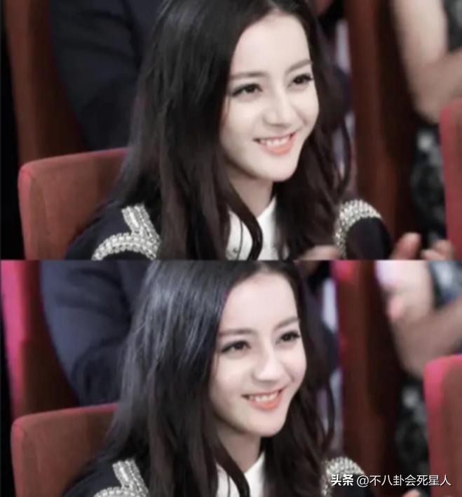 戴牙套是双刃剑：毛不易拯救一口烂牙，刘雯、肖战却变难看了