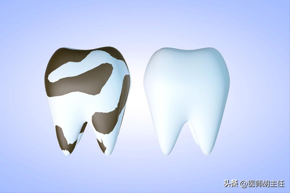 牙缝中的牙结石怎么去除,牙缝的牙结石怎么自己去除