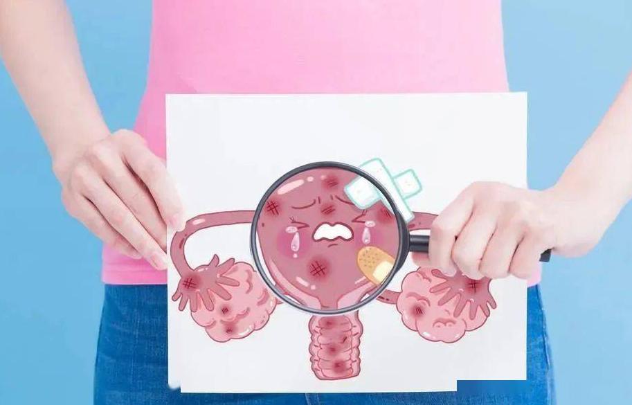 宫颈癌现象,宫颈癌是突发的吗