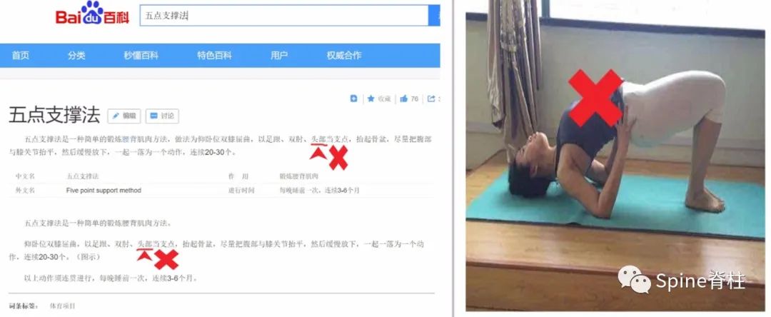 腰椎间盘突出症的治疗方法,腰椎间盘突出症状主要有哪些